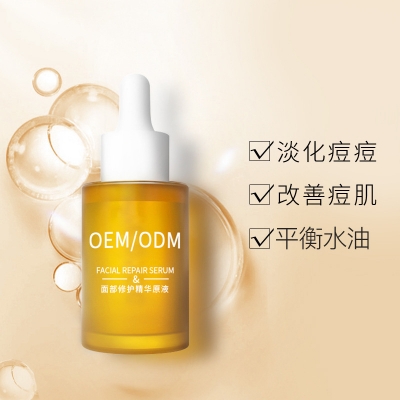 广州壹美化妆品_祛痘精华原液OEM